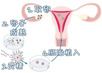关于靠谱拉拉借卵咨询